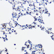 Immunohistochemistry analysis of paraffin-embedded rat lung using UBE2L3 Rabbit polyclonal antibody (STJ26020) at dilution of 1:100 (40x lens). Perform high pressure antigen retrieval with 10 mM citrate buffer pH 6. 0 before commencing with immunohistochemistry staining protocol.