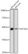 Western blot analysis of extracts of various cell lines, using UGT1A1 antibody (STJ26036) at 1:1000 dilution. Secondary antibody: HRP Goat Anti-rabbit IgG (H+L) (STJS000856) at 1:10000 dilution. Lysates/proteins: 25 Mu g per lane. Blocking buffer: 3% non-fat dry milk in TBST. Detection: ECL Enhanced Kit. Exposure time: 180s.