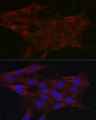 Immunofluorescence analysis of C6 cells using UGT1A1 rabbit polyclonal antibody (STJ26036) at dilution of 1:200 (40x lens). Blue: DAPI for nuclear staining.