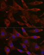 Immunofluorescence analysis of NIH/3T3 cells using UGT1A1 rabbit polyclonal antibody (STJ26036) at dilution of 1:200 (40x lens). Blue: DAPI for nuclear staining.