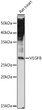 Western blot analysis of extracts of Rat heart, using VEGFB Rabbit polyclonal antibody (STJ26086) at 1:500 dilution. Secondary antibody: HRP Goat Anti-Rabbit IgG (H+L) (STJS000856) at 1:10000 dilution. Lysates/proteins: 25 Mu g per lane. Blocking buffer: 3% nonfat dry milk in TBST. Detection: ECL Enhanced Kit. Exposure time: 180s.