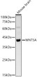 Western blot analysis of lysates from Mouse brain, using WNT5A Rabbit polyclonal antibody (STJ26117) at 1:1000 dilution. Secondary antibody: HRP Goat Anti-Rabbit IgG (H+L) (STJS000856) at 1:10000 dilution. Lysates/proteins: 25 Mu g per lane. Blocking buffer: 3% nonfat dry milk in TBST. Detection: ECL Basic Kit. Exposure time: 30s.