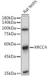 Western blot analysis of lysates from Rat testis, using XRCC4 Rabbit polyclonal antibody (STJ26132) at 1:1000 dilution. Secondary antibody: HRP Goat Anti-Rabbit IgG (H+L) (STJS000856) at 1:10000 dilution. Lysates/proteins: 25 Mu g per lane. Blocking buffer: 3% nonfat dry milk in TBST. Detection: ECL Basic Kit. Exposure time: 6s.