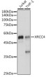 Western blot analysis of various lysates using XRCC4 Rabbit polyclonal antibody (STJ26132) at 1:1000 dilution. Secondary antibody: HRP Goat Anti-Rabbit IgG (H+L) (STJS000856) at 1:10000 dilution. Lysates/proteins: 25 Mu g per lane. Blocking buffer: 3% nonfat dry milk in TBST. Detection: ECL Enhanced Kit. Exposure time: 1s.
