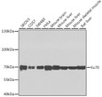 Western blot analysis of extracts of various cell lines, using Ku70 antibody (STJ26134) at 1:1000 dilution. Secondary antibody: HRP Goat Anti-Rabbit IgG (H+L) (STJS000856) at 1:10000 dilution. Lysates/proteins: 25 Mu g per lane. Blocking buffer: 3% nonfat dry milk in TBST. Detection: ECL Enhanced Kit. Exposure time: 60s.
