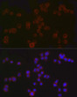 Immunofluorescence analysis of Jurkat cells using CD4 Rabbit polyclonal antibody (STJ26171) at dilution of 1:50 (40x lens). Blue: DAPI for nuclear staining.