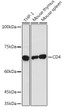 Western blot analysis of extracts of various cell lines, using CD4 antibody (STJ26171) at 1:1000 dilution. Secondary antibody: HRP Goat Anti-Rabbit IgG (H+L) (STJS000856) at 1:10000 dilution. Lysates/proteins: 25 Mu g per lane. Blocking buffer: 3% nonfat dry milk in TBST. Detection: ECL Basic Kit. Exposure time: 30s.