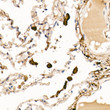 Immunohistochemistry analysis of paraffin-embedded human lung using Ferritin Light Chain rabbit polyclonal antibody (STJ26177) at dilution of 1:100 (40x lens). Perform high pressure antigen retrieval with 10 mM citrate buffer pH 6. 0 before commencing with immunohistochemistry staining protocol.