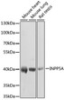 Western blot analysis of extracts of various cell lines, using INPP5A antibody (STJ26233) at 1:1000 dilution. Secondary antibody: HRP Goat Anti-Rabbit IgG (H+L) (STJS000856) at 1:10000 dilution. Lysates/proteins: 25 Mu g per lane. Blocking buffer: 3% nonfat dry milk in TBST. Detection: ECL Basic Kit. Exposure time: 30s.