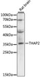 Western blot analysis of lysates from rat brain, using THAP2 Rabbit polyclonal antibody (STJ26366) at 1:3000 dilution. Secondary antibody: HRP Goat Anti-Rabbit IgG (H+L) (STJS000856) at 1:10000 dilution. Lysates/proteins: 25 Mu g per lane. Blocking buffer: 3% nonfat dry milk in TBST. Detection: ECL Enhanced Kit. Exposure time: 5s.