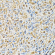 Immunohistochemistry analysis of paraffin-embedded rat ovary using RBBP9 Rabbit polyclonal antibody (STJ26678) at dilution of 1:200 (40x lens). Perform high pressure antigen retrieval with 10 mM citrate buffer pH 6. 0 before commencing with immunohistochemistry staining protocol.