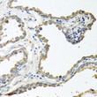 Immunohistochemistry analysis of paraffin-embedded human prostate using COLEC11 antibody (STJ26983) at dilution of 1:100 (40x lens). Perform microwave antigen retrieval with 10 mM PBS buffer pH 7. 2 before commencing with immunohistochemistry staining protocol.