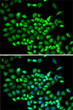 Immunofluorescence analysis of A-549 cells using Cullin 2 antibody (STJ27261). Blue: DAPI for nuclear staining.