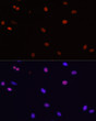 Immunofluorescence analysis of C6 cells using HDGF antibody (STJ27300) at dilution of 1:100. Blue: DAPI for nuclear staining.