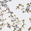 Immunohistochemistry analysis of paraffin-embedded mouse lung using HDGF Antibody (STJ27300) at dilution of 1:100 (40x lens). Perform microwave antigen retrieval with 10 mM PBS buffer pH 7. 2 before commencing with immunohistochemistry staining protocol.
