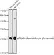 Western blot analysis of extracts of various cell lines, using Myelin oligodendrocyte glycoprotein antibody (STJ27306) at 1:1000 dilution. Secondary antibody: HRP Goat Anti-Rabbit IgG (H+L) (STJS000856) at 1:10000 dilution. Lysates/proteins: 25 Mu g per lane. Blocking buffer: 3% nonfat dry milk in TBST. Detection: ECL Basic Kit. Exposure time: 30s.