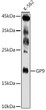 Western blot analysis of extracts of K-562 cells, using GP9 antibody (STJ27327) at 1:500 dilution. Secondary antibody: HRP Goat Anti-Rabbit IgG (H+L) (STJS000856) at 1:10000 dilution. Lysates/proteins: 25 Mu g per lane. Blocking buffer: 3% nonfat dry milk in TBST. Detection: ECL Enhanced Kit. Exposure time: 180s.