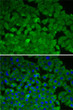 Immunofluorescence analysis of A-549 cells using EEF2K antibody (STJ27357). Blue: DAPI for nuclear staining.