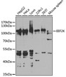 Western blot analysis of extracts of various cell lines, using EEF2K antibody (STJ27357) at 1:1000 dilution. Secondary antibody: HRP Goat Anti-Rabbit IgG (H+L) (STJS000856) at 1:10000 dilution. Lysates/proteins: 25 Mu g per lane. Blocking buffer: 3% nonfat dry milk in TBST. Detection: ECL Basic Kit. Exposure time: 40s.