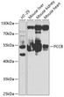 Western blot analysis of extracts of various cell lines, using PCCB antibody (STJ27368) at 1:1000 dilution. Secondary antibody: HRP Goat Anti-Rabbit IgG (H+L) (STJS000856) at 1:10000 dilution. Lysates/proteins: 25 Mu g per lane. Blocking buffer: 3% nonfat dry milk in TBST. Detection: ECL Basic Kit. Exposure time: 20s.