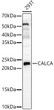 Western blot analysis of 293T, using CALCA Rabbit polyclonal antibody (STJ27409) at 1:2500 dilution. Secondary antibody: HRP Goat Anti-Rabbit IgG (H+L) (STJS000856) at 1:10000 dilution. Lysates/proteins: 25 Mu g per lane. Blocking buffer: 3% nonfat dry milk in TBST. Detection: ECL Enhanced Kit. Exposure time: 30s.