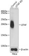 Western blot analysis of lysates from wild type (WT) and LITAF knockout (KO) HeLa cells, using [KO Validated] LITAF Rabbit polyclonal antibody (STJ27422) at 1:1000 dilution. Secondary antibody: HRP Goat Anti-Rabbit IgG (H+L) (STJS000856) at 1:10000 dilution. Lysates/proteins: 25 Mu g per lane. Blocking buffer: 3% nonfat dry milk in TBST. Detection: ECL Basic Kit. Exposure time: 1s.
