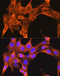 Immunofluorescence analysis of NIH-3T3 cells using PFKM Rabbit polyclonal antibody (STJ27430) at dilution of 1:100 (40x lens). Blue: DAPI for nuclear staining. Immunofluorescence analysis of NIH-3T3 cells using PFKM Rabbit polyclonal antibody (STJ27430) at dilution of 1:100 (40x lens). Blue: DAPI for nuclear staining.