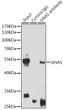 Immunoprecipitation analysis of 200 Mu g extracts of Mouse brain cells using 3 Mu g GNAS antibody (STJ27492). Western blot was performed from the immunoprecipitate using GNAS antibody (STJ27492) at a dilution of 1:1000.