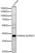 Western blot analysis of lysates from Jurkat cells, using RING1B/RNF2 Rabbit polyclonal antibody (STJ27509) at 1:400 dilution. Secondary antibody: HRP Goat Anti-Rabbit IgG (H+L) (STJS000856) at 1:10000 dilution. Lysates/proteins: 25 Mu g per lane. Blocking buffer: 3% nonfat dry milk in TBST. Detection: ECL Basic Kit. Exposure time: 1s.