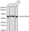 Western blot analysis of various lysates using FKBP52/FKBP4 Rabbit polyclonal antibody (STJ27610) at 1:1000 dilution. Secondary antibody: HRP Goat Anti-Rabbit IgG (H+L) (STJS000856) at 1:10000 dilution. Lysates/proteins: 25 Mu g per lane. Blocking buffer: 3% nonfat dry milk in TBST. Detection: ECL Basic Kit. Exposure time: 5s.