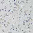 Immunohistochemistry analysis of HTR3A in paraffin-embedded rat brain using HTR3A Rabbit polyclonal antibody (STJ27614) at dilution of 1:100 (40x lens). Perform microwave antigen retrieval with 10 mM PBS buffer pH 7. 2 before commencing with immunohistochemistry staining protocol.