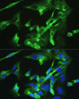 Immunofluorescence analysis of U-2OS cells using BMPR2 antibody (STJ27633) at dilution of 1:100. Blue: DAPI for nuclear staining.
