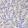 Immunohistochemistry analysis of paraffin-embedded mouse kidney using GST3/GST3/GSTP1 antibody (STJ27658) at dilution of 1:200 (40x lens). Perform microwave antigen retrieval with 10 mM PBS buffer pH 7. 2 before commencing with immunohistochemistry staining protocol.