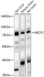 Western blot analysis of various lysates using MECP2 Rabbit polyclonal antibody (STJ27661) at 1:2000 dilution. Secondary antibody: HRP Goat Anti-Rabbit IgG (H+L) (STJS000856) at 1:10000 dilution. Lysates/ proteins: 25 Mu g per lane. Blocking buffer: 3 % nonfat dry milk in TBST. Detection: ECL Basic Kit. Exposure time: 20s.
