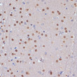 Immunohistochemistry analysis of paraffin-embedded mouse brain using TP53BP2 antibody (STJ27671) at dilution of 1:100 (40x lens). Perform microwave antigen retrieval with 10 mM PBS buffer pH 7. 2 before commencing with immunohistochemistry staining protocol.