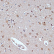 Immunohistochemistry analysis of paraffin-embedded rat brain using TP53BP2 antibody (STJ27671) at dilution of 1:100 (40x lens). Perform microwave antigen retrieval with 10 mM PBS buffer pH 7. 2 before commencing with immunohistochemistry staining protocol.