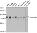 Western blot analysis of various lysates using HNRNPA0 Rabbit polyclonal antibody (STJ27825) at 1:3000 dilution. Secondary antibody: HRP Goat Anti-Rabbit IgG (H+L) (STJS000856) at 1:10000 dilution. Lysates/proteins: 25 Mu g per lane. Blocking buffer: 3% nonfat dry milk in TBST. Detection: ECL Basic Kit. Exposure time: 1s.