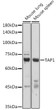Western blot analysis of various lysates using TAP1 Rabbit polyclonal antibody (STJ27969) at 1:1000 dilution. Secondary antibody: HRP Goat Anti-Rabbit IgG (H+L) (STJS000856) at 1:10000 dilution. Lysates/proteins: 25 Mu g per lane. Blocking buffer: 3% nonfat dry milk in TBST. Detection: ECL Basic Kit. Exposure time: 10s.