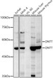 Western blot analysis of extracts of various cell lines, using TdT antibody (STJ28010) at 1:500 dilution. Secondary antibody: HRP Goat Anti-Rabbit IgG (H+L) (STJS000856) at 1:10000 dilution. Lysates/proteins: 25 Mu g per lane. Blocking buffer: 3% nonfat dry milk in TBST. Detection: ECL Enhanced Kit. Exposure time: 90s.