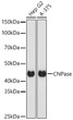 Western blot analysis of various lysates using CNPase Rabbit polyclonal antibody (STJ28022) at 1:1000 dilution. Secondary antibody: HRP Goat Anti-Rabbit IgG (H+L) (STJS000856) at 1:10000 dilution. Lysates/ proteins: 25 Mu g per lane. Blocking buffer: 3 % nonfat dry milk in TBST. Detection: ECL Basic Kit. Exposure time: 1s.