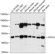 Western blot analysis of various lysates using HTR1D Rabbit polyclonal antibody (STJ28077) at 1:1000 dilution. Secondary antibody: HRP Goat Anti-Rabbit IgG (H+L) (STJS000856) at 1:10000 dilution. Lysates/proteins: 25 Mu g per lane. Blocking buffer: 3% nonfat dry milk in TBST. Detection: ECL Basic Kit. Exposure time: 10s.