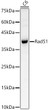 Western blot analysis of C6, using Rad51 antibody (STJ28190) at 1:400 dilution. Secondary antibody: HRP Goat Anti-rabbit IgG (H+L) (STJS000856) at 1:10000 dilution. Lysates/proteins: 25 Mu g per lane. Blocking buffer: 3% non-fat dry milk in TBST. Detection: ECL Basic Kit. Exposure time: 30s.
