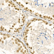 Immunohistochemistry analysis of paraffin-embedded mouse testis using Rad51 rabbit polyclonal antibody (STJ28190) at dilution of 1:50 (40x lens). Perform high pressure antigen retrieval with 10 mM citrate buffer pH 6. 0 before commencing with immunohistochemistry staining protocol.