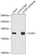 Immunoprecipitation analysis of 200 Mu g extracts of HeLa cells using 3 Mu g CCAR1 antibody (STJ28256). Western blot was performed from the immunoprecipitate using CCAR1 antibody (STJ28256) at a dilution of 1:500.