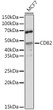 Western blot analysis of extracts of MCF7 cells, using CD82 antibody (STJ28271) at 1:500 dilution. Secondary antibody: HRP Goat Anti-Rabbit IgG (H+L) (STJS000856) at 1:10000 dilution. Lysates/proteins: 25 Mu g per lane. Blocking buffer: 3% nonfat dry milk in TBST. Detection: ECL Basic Kit. Exposure time: 90s.