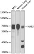 Western blot analysis of extracts of various cell lines, using NAB2 antibody (STJ28390) at 1:1000 dilution. Secondary antibody: HRP Goat Anti-Rabbit IgG (H+L) (STJS000856) at 1:10000 dilution. Lysates/proteins: 25 Mu g per lane. Blocking buffer: 3% nonfat dry milk in TBST. Detection: ECL Basic Kit. Exposure time: 90s.