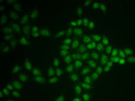 Immunofluorescence analysis of U2OS cells using BTG1 antibody (STJ28442). Immunofluorescence analysis of U2OS cells using BTG1 antibody (STJ28442).