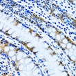 Immunohistochemistry analysis of paraffin-embedded human colon using IMPA1 antibody (STJ28464) at dilution of 1:100 (40x lens). Perform microwave antigen retrieval with 10 mM PBS buffer pH 7. 2 before commencing with immunohistochemistry staining protocol.