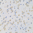 Immunohistochemistry analysis of paraffin-embedded mouse brain using MSRA antibody (STJ28472) at dilution of 1:100 (40x lens). Perform microwave antigen retrieval with 10 mM PBS buffer pH 7. 2 before commencing with immunohistochemistry staining protocol.