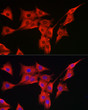 Immunofluorescence analysis of PC-12 cells using MSRA rabbit polyclonal antibody (STJ28472) at dilution of 1:300 (40x lens). Blue: DAPI for nuclear staining.